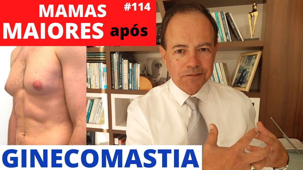 Mamas masculinas estão maiores após a GINECOMASTIA [Cirurgia Plástica]
