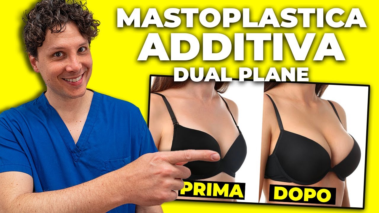 Mastoplastica Additiva Dual Plane: Intervento di Sephora