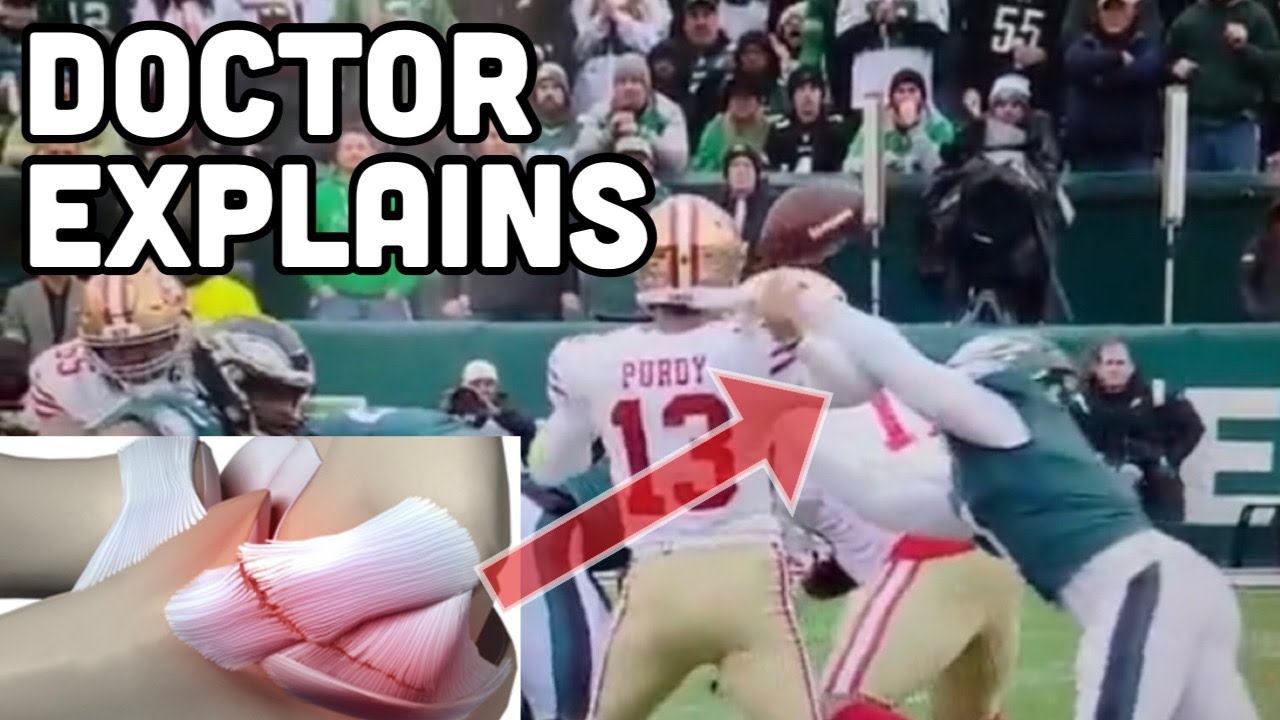 Brock Purdy Elbow Injury - How bad is it? Doctor Explains