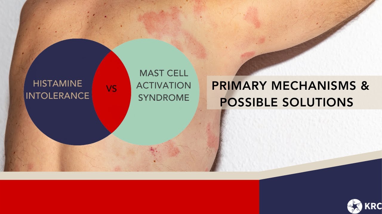 Possible Solutions For Histamine Intolerance and MCAS