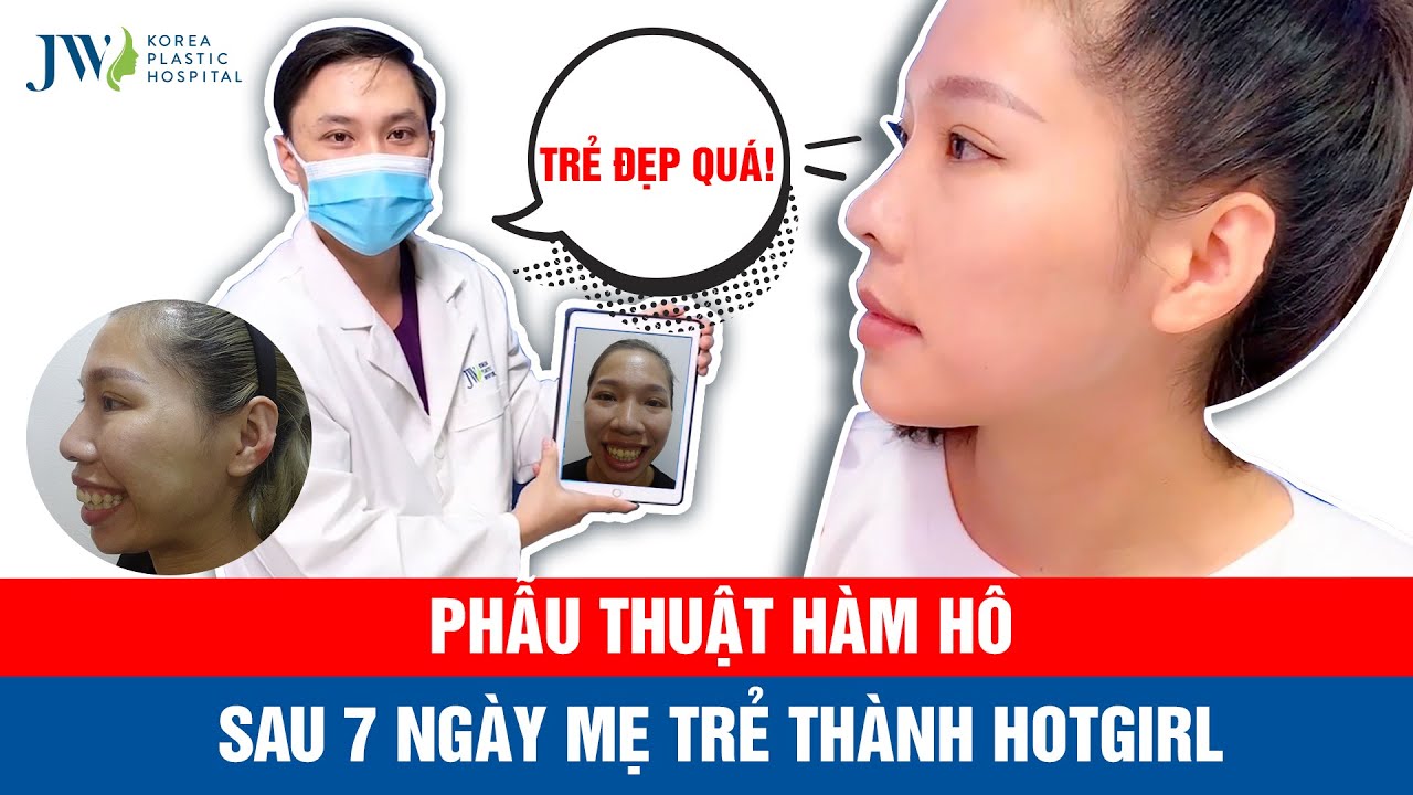 Phẫu thuật hàm hô Trượt cằm MẸ 2 CON đỏ mặt bị lầm thành HOTGIRL CHƯA CHỒNG vì quá TRẺ ĐẸP
