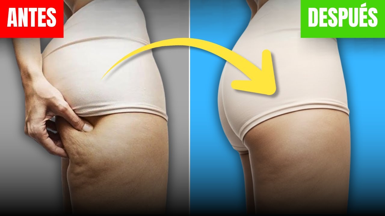 La forma MÁS simple - elimina la celulitis PARA SIEMPRE