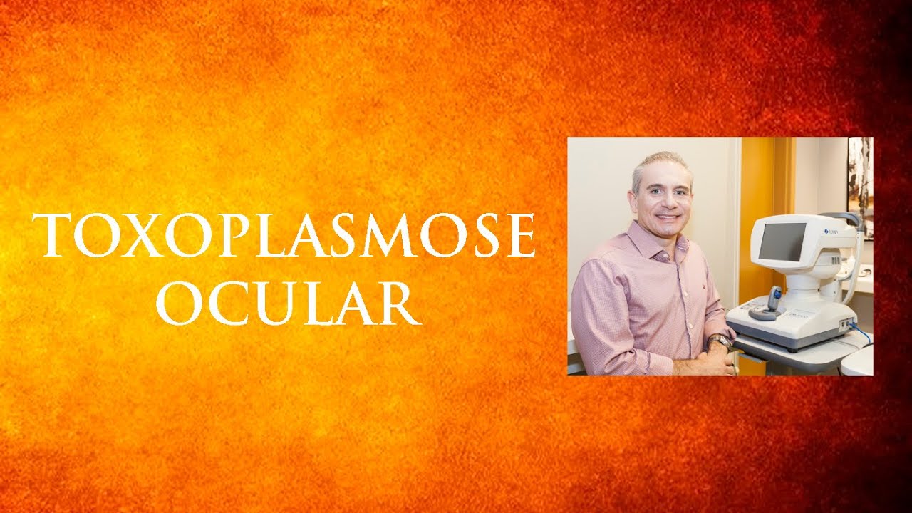 Toxoplasmose Ocular | Dr. Gilson Mariano | Oftalmologista