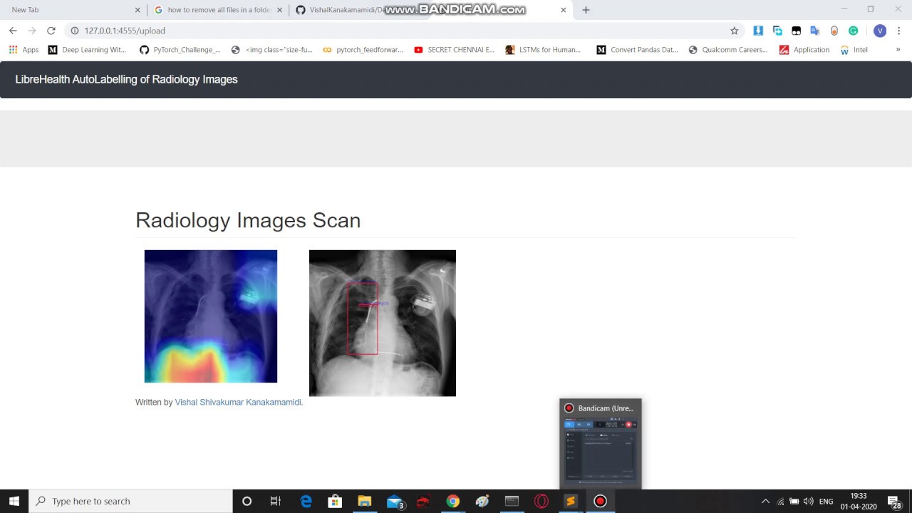 DenseNet-121 for Radiology Images Annotation and Segmentation