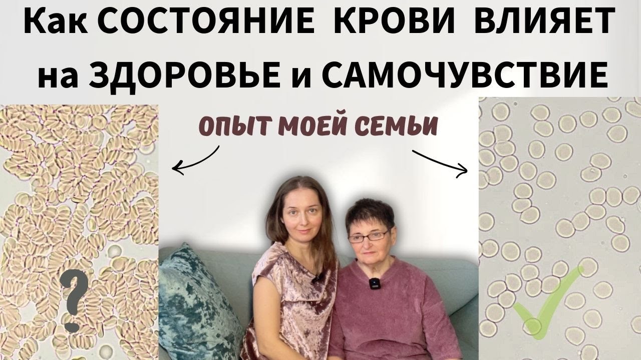 ПОСЛЕДСТВИЯ ГУСТОЙ КРОВИ... Зачем разжижать кровь?