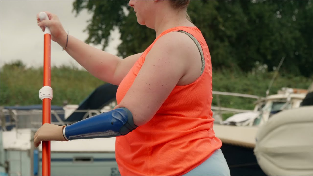 Stand Up Paddle Boarding with the unique Moveable mHand Adapt - prosthetic hand for arm prosthesis