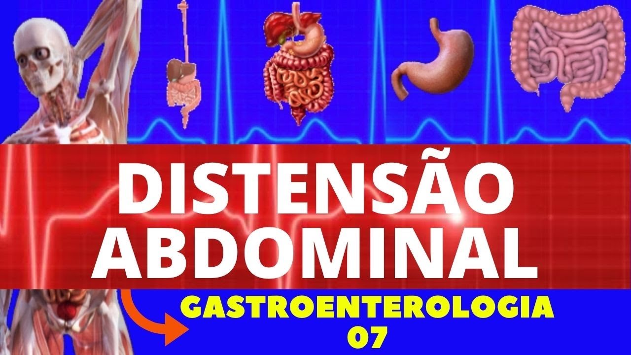 DISTENS&Atilde;O ABDOMINAL (CAUSAS, SINTOMAS, DIAGN&Oacute;STICO E TRATAMENTO) - GASTROENTEROLOGIA