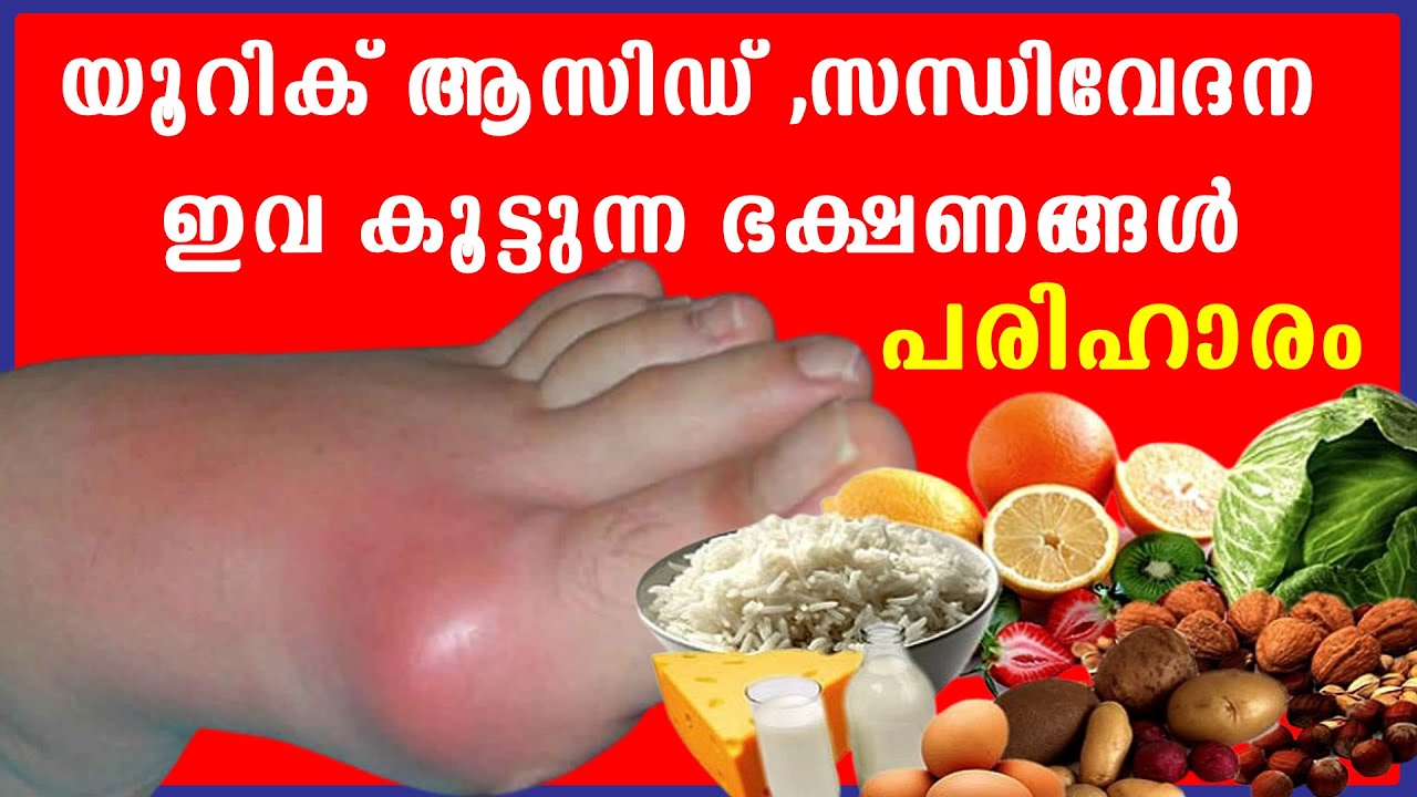 യൂറിക് ആസിഡ് സന്ധിവേദന ഇവ കൂട്ടുന്ന ഭക്ഷണങ്ങൾ,അറ്റാക്ക്‌ ആകാതിരിക്കാന്‍ ചെയ്യേണ്ടത് /Baiju's Vlogs