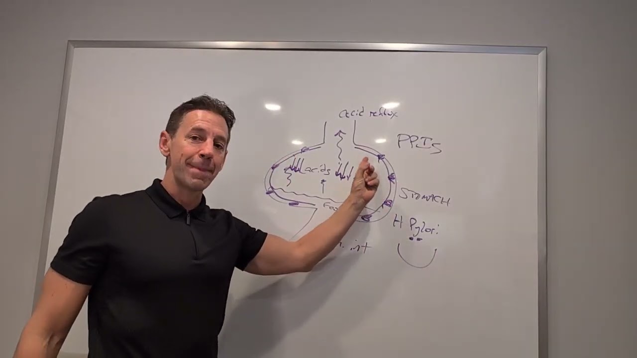 Is Your GI doctor Just Masking the Root Cause of Your Heartburn With Your PPI Medications?