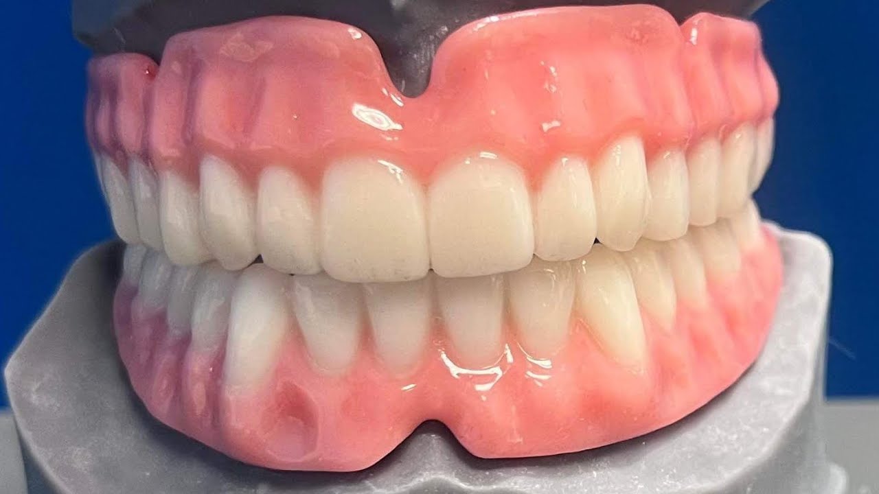 DENTKITS DENTURE FINALS ARE HERE!!!