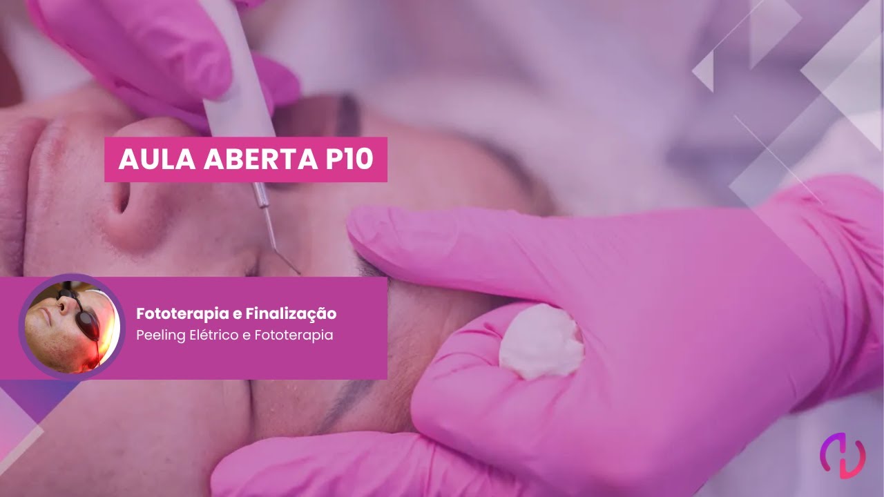Aula Aberta #P10 - Finalização - Peeling Elétrico para Cicatrizes de Acne