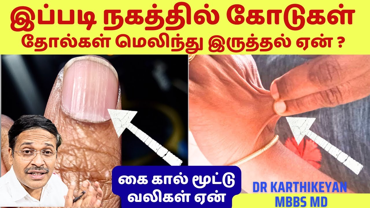 இப்படி நகத்தில் கோடுகளும் தோலும் இருத்தல் சத்து பிரச்சினையா? collagen deficiency vitamin mineral?