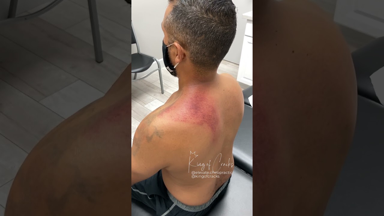 Chiropractic Adjustment Compilation Video by The King of Cracks! Full Body Cracks *ASMR*