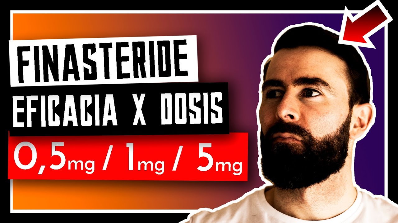 Diferentes Dosis De Finasteride Vs Dutasteride