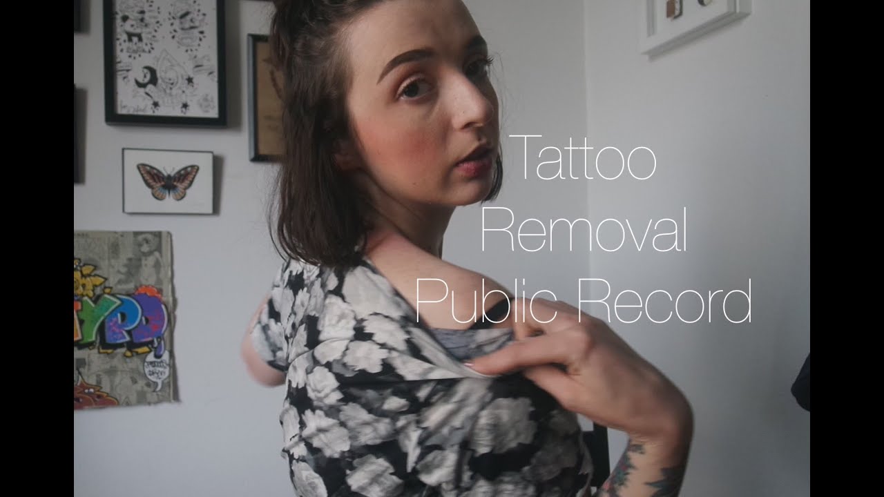 Tattoo Removal, Public Record ep.3