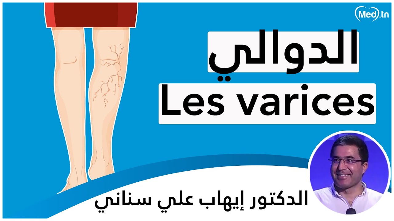 الدوالي | الدكتور ايهاب علي السناني