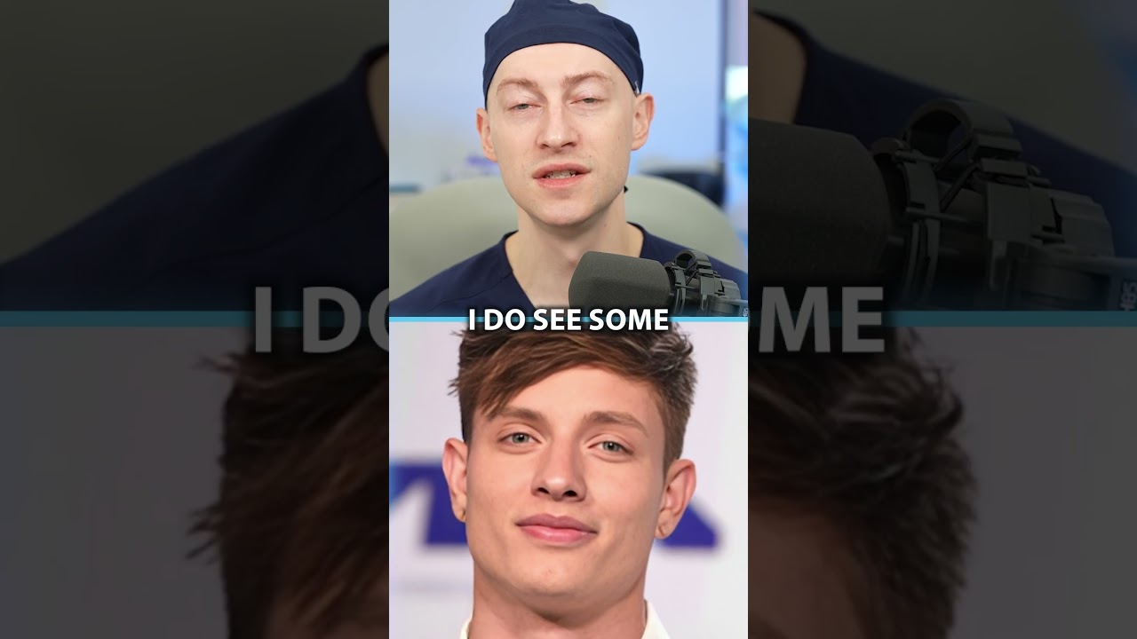 Has Matt Rife Had Plastic Surgery?