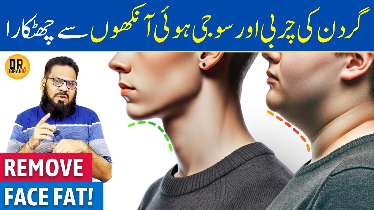 Gardan Ki Charbi & Ankhon Ki Sujan Ka Ilaj | Rid Double Chin Fat & Puffy Eyes | Dr. Ibrahim