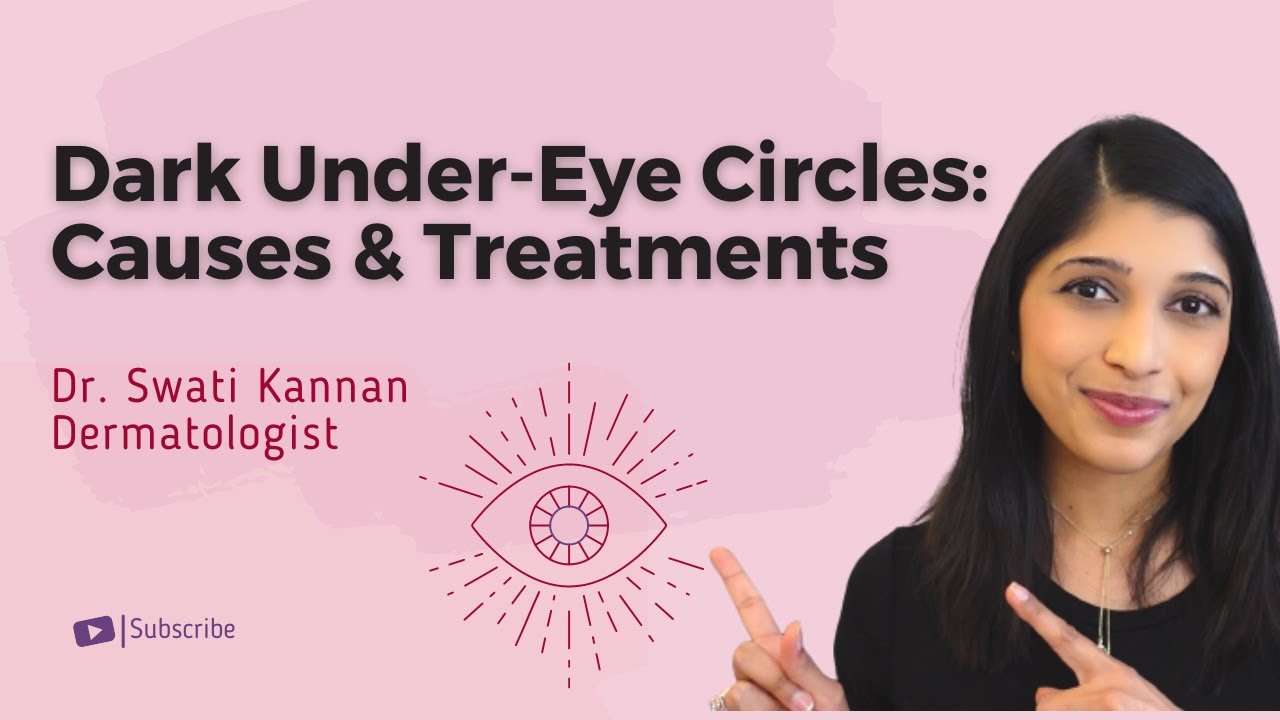 How To Treat Dark Under-Eye Circles | Dr. Swati Kannan