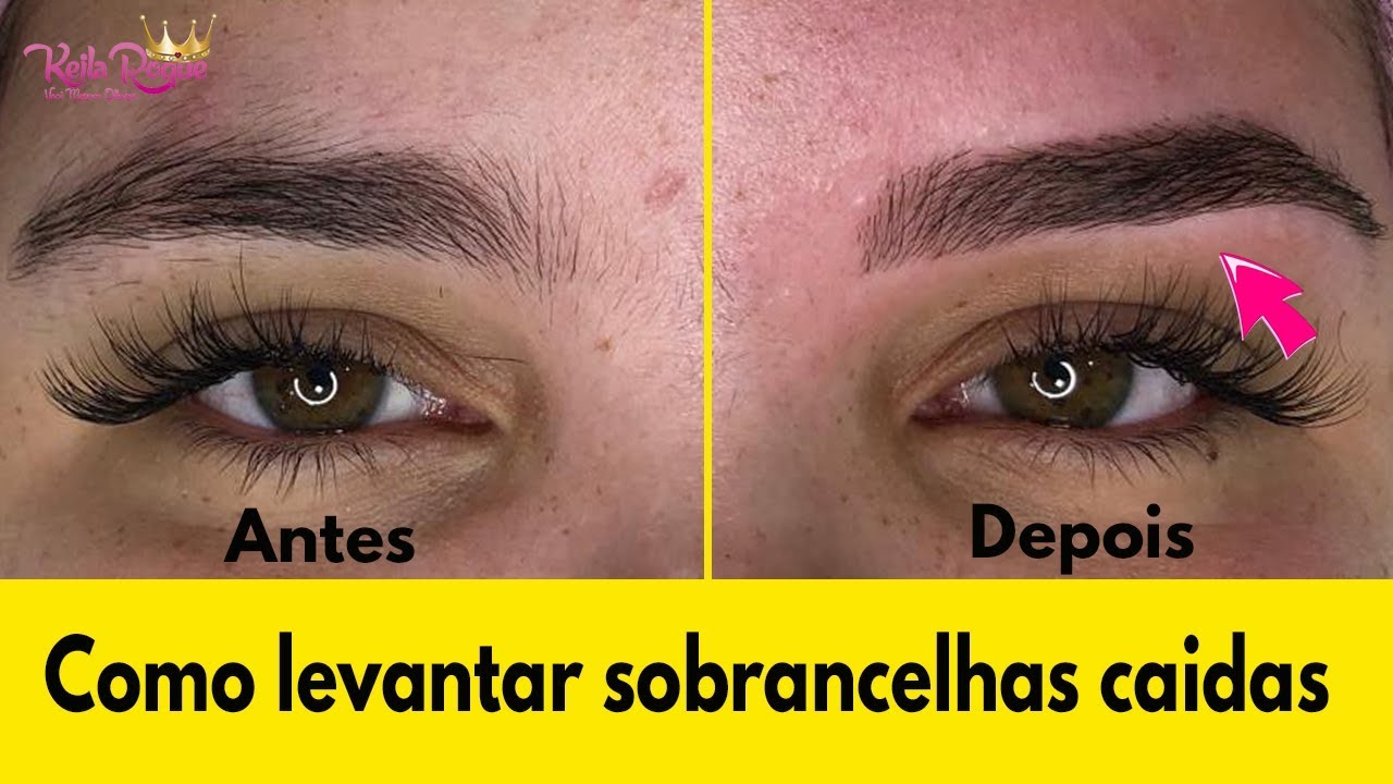 Como levantar sobrancelhas baixa e caidas passo a passo