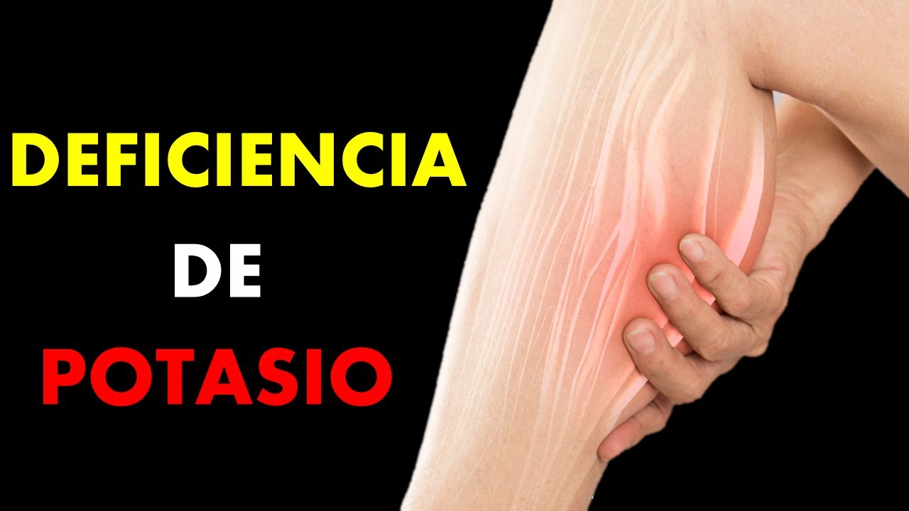 🔴 8 Signos de DEFICIENCIA DE POTASIO que debes conocer