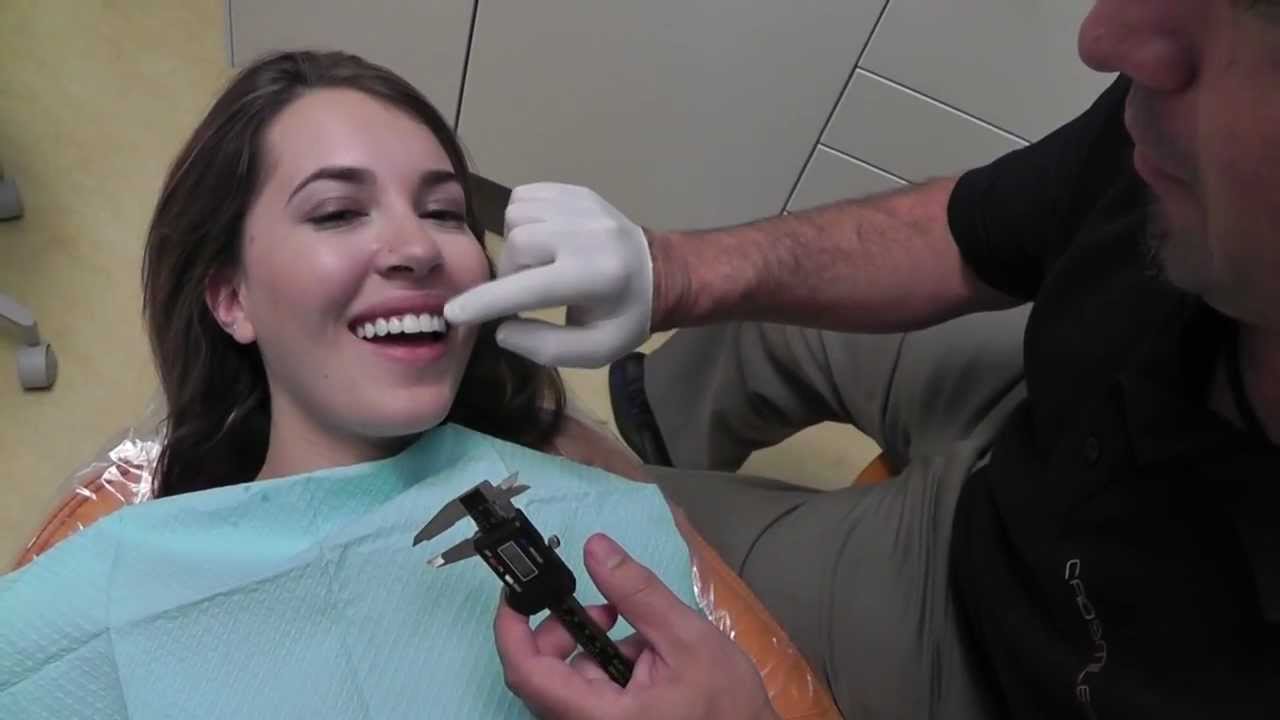 One Day Smile Makeover Cosmetic Dentistry Cerec Veneer