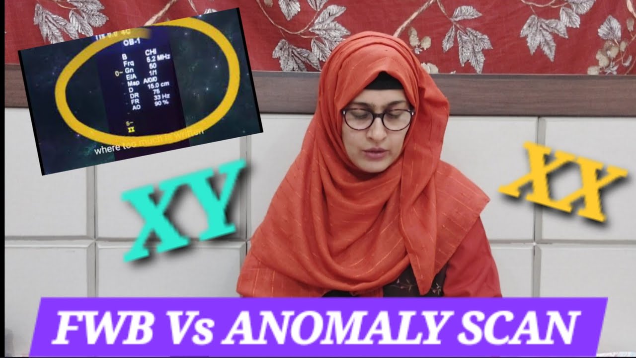 Детали УЗИ GenderReveal | XX на снимке УЗИ | Большое количество амниотической жидкости | Сканиров...