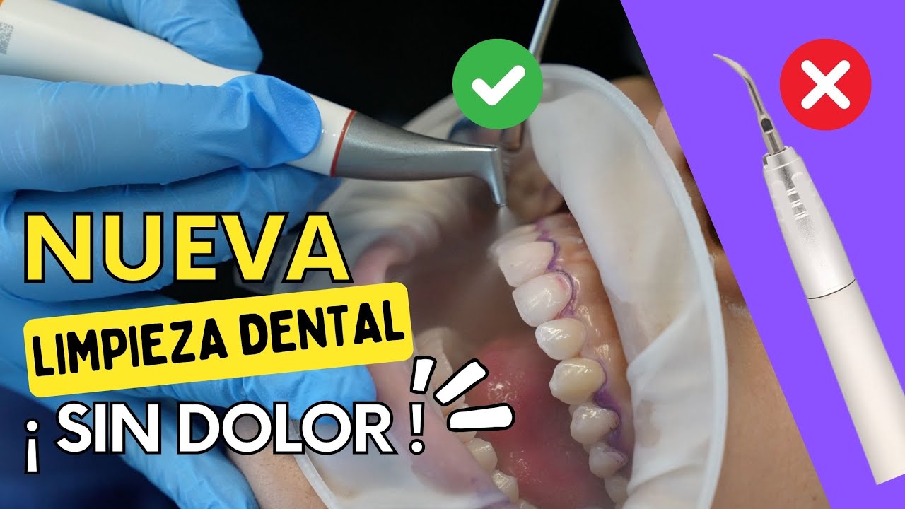 Nueva Limpieza Dental SIN DOLOR y sin rayar tu esmalte | Tienes que conocer el Air Flow 2024