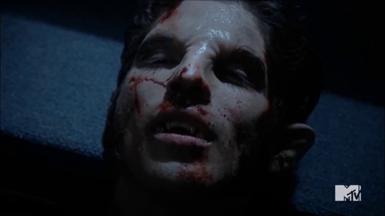 Teen Wolf | Human