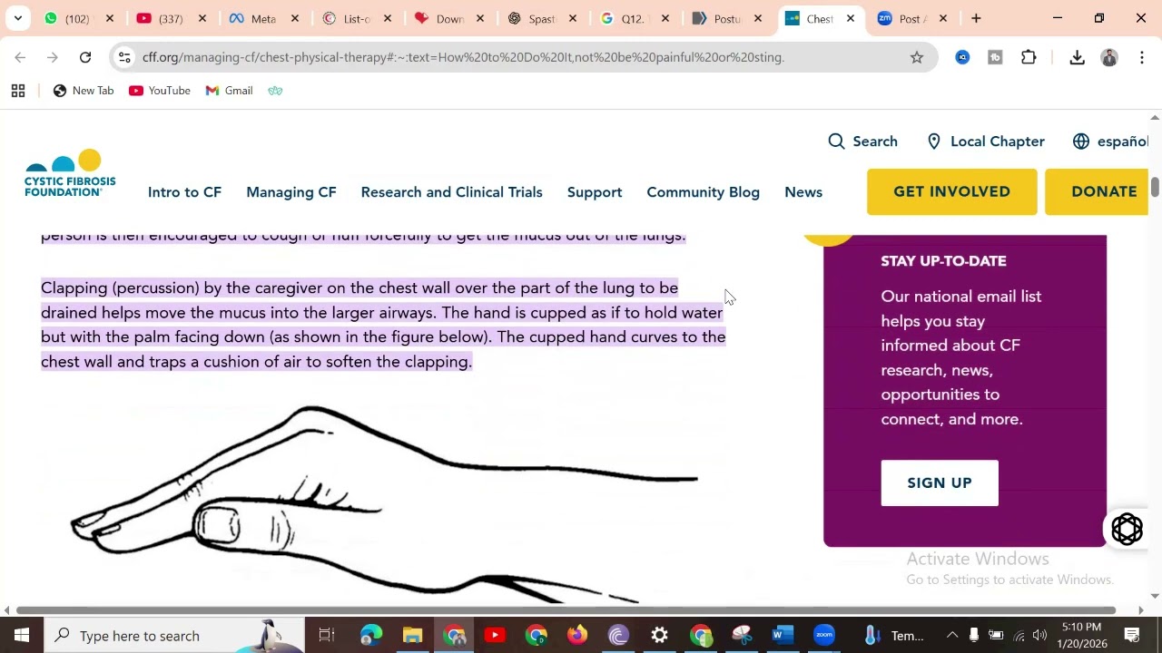 Chest Physiotherapy || Cardiopulmonary || CMT Academy for Different Licensure Exams for Physios ||