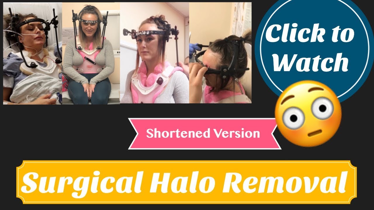 Surgical Halo Removal