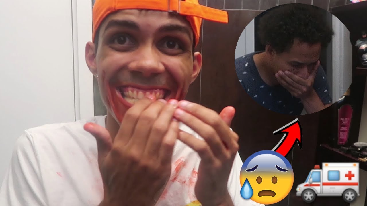 ME ROMP&Iacute; LA BOCA Y MI AMIGO ENTRO EN P&Aacute;NICO! *LLAM&Oacute; A EMERGENCIAS!*