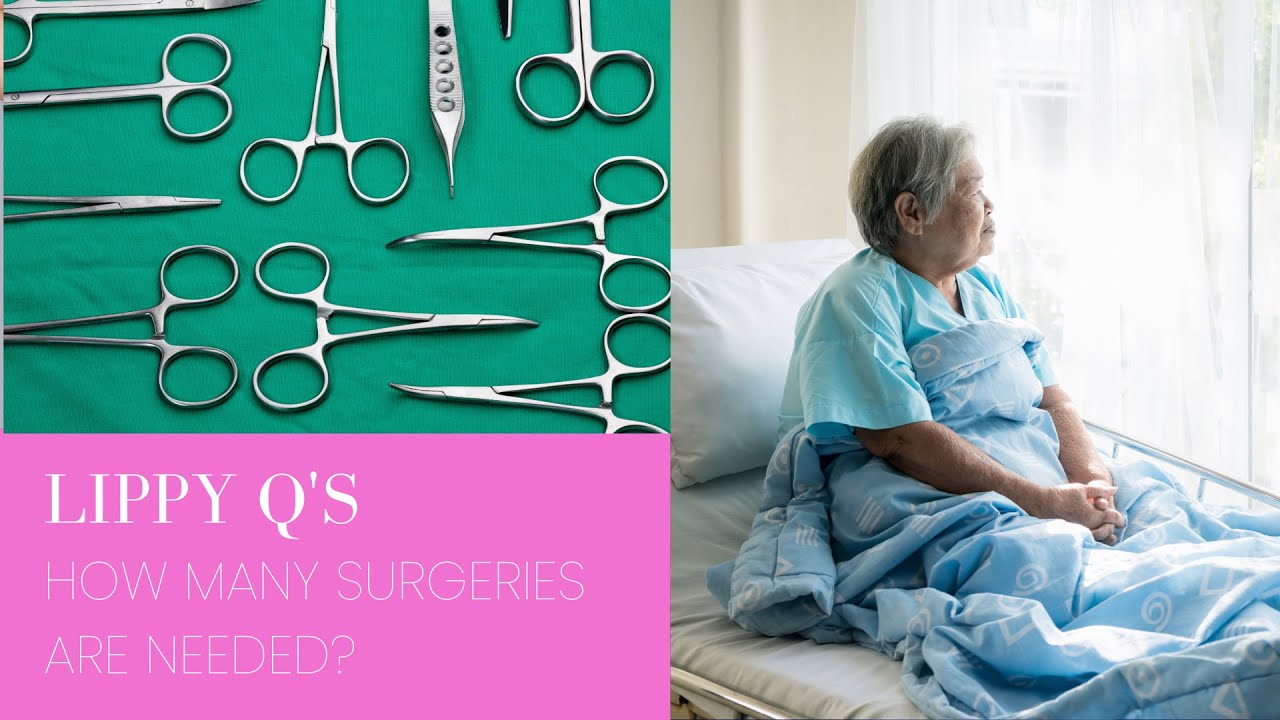 Lipedema Question of the Week | Episode 20: How Many Surgeries Are Needed? | Dr. David Amron