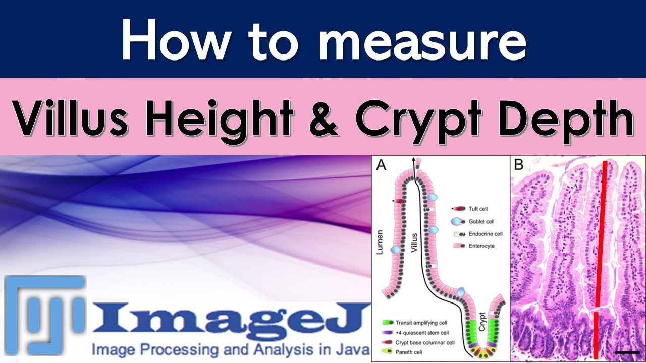 Measurement of villus height and crypt depth with ImageJ | Morphometry of intestine