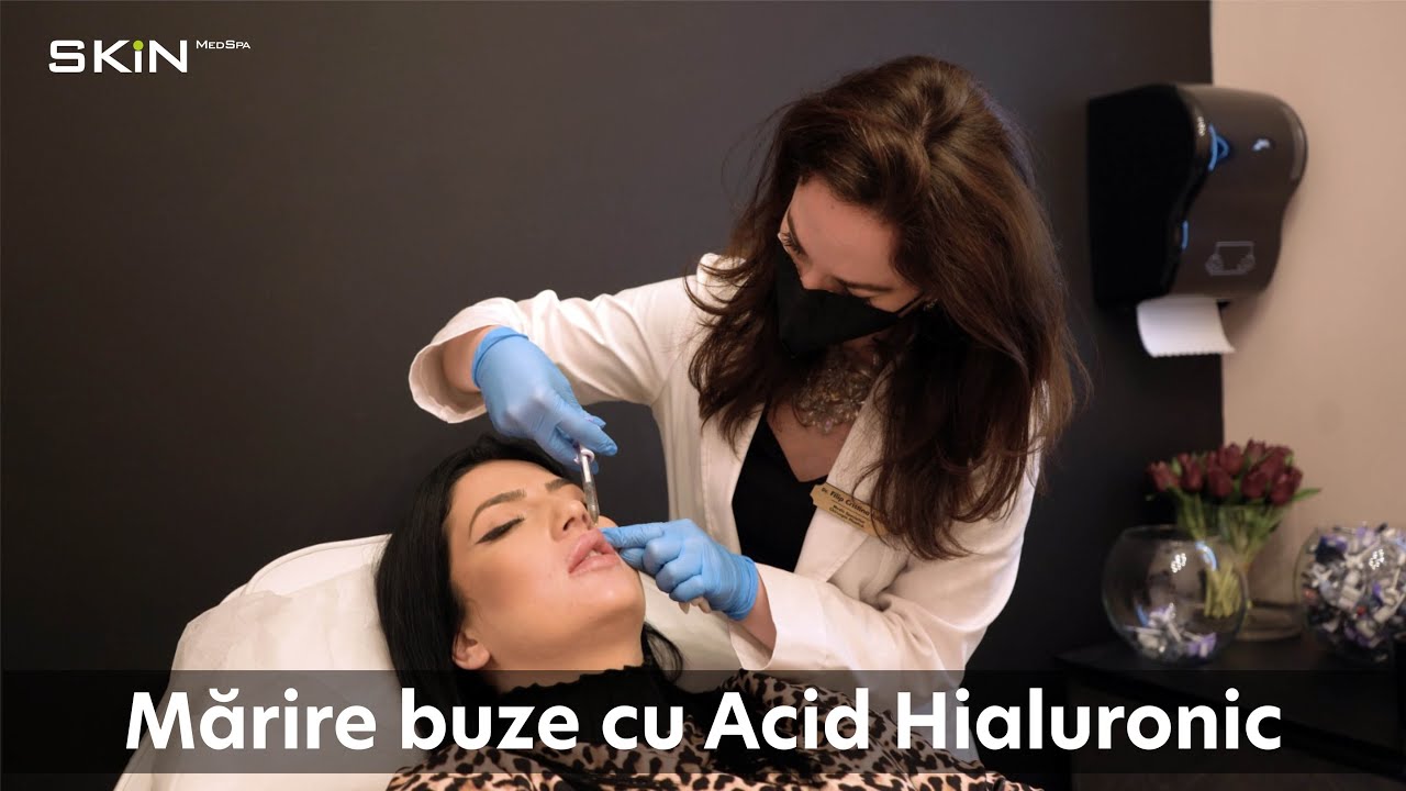 Mărire buze cu acid hialuronic👄 | Augmentare buze | Hidratare pentru buze senzuale @SKiN MedSpa
