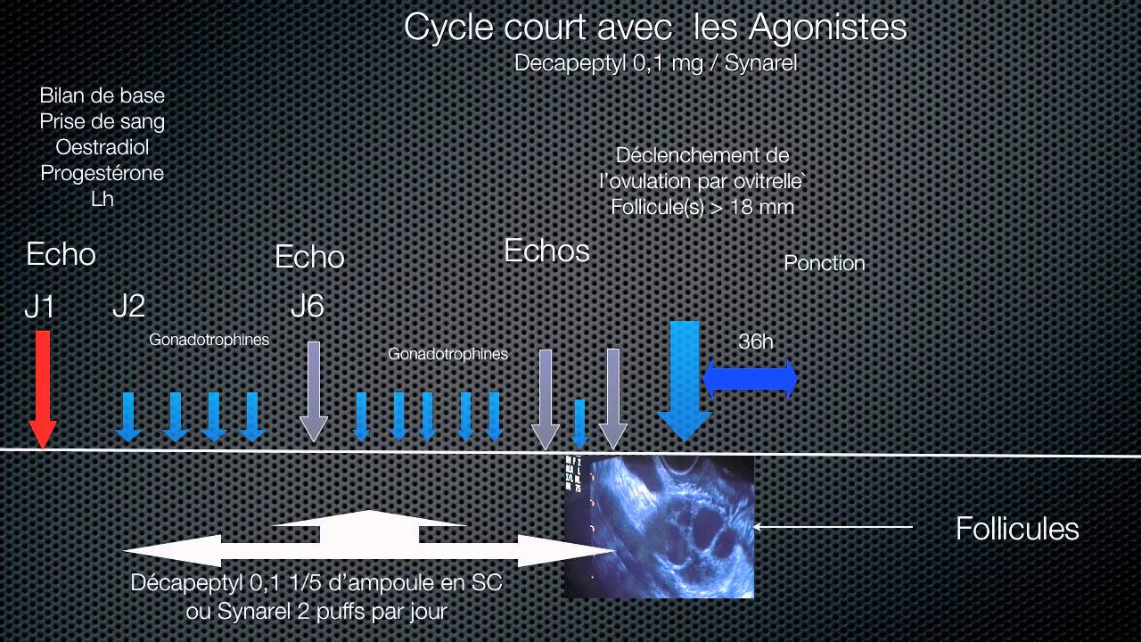 Principe de la stimulation ovarienne au cours de la FIV : Protocoles