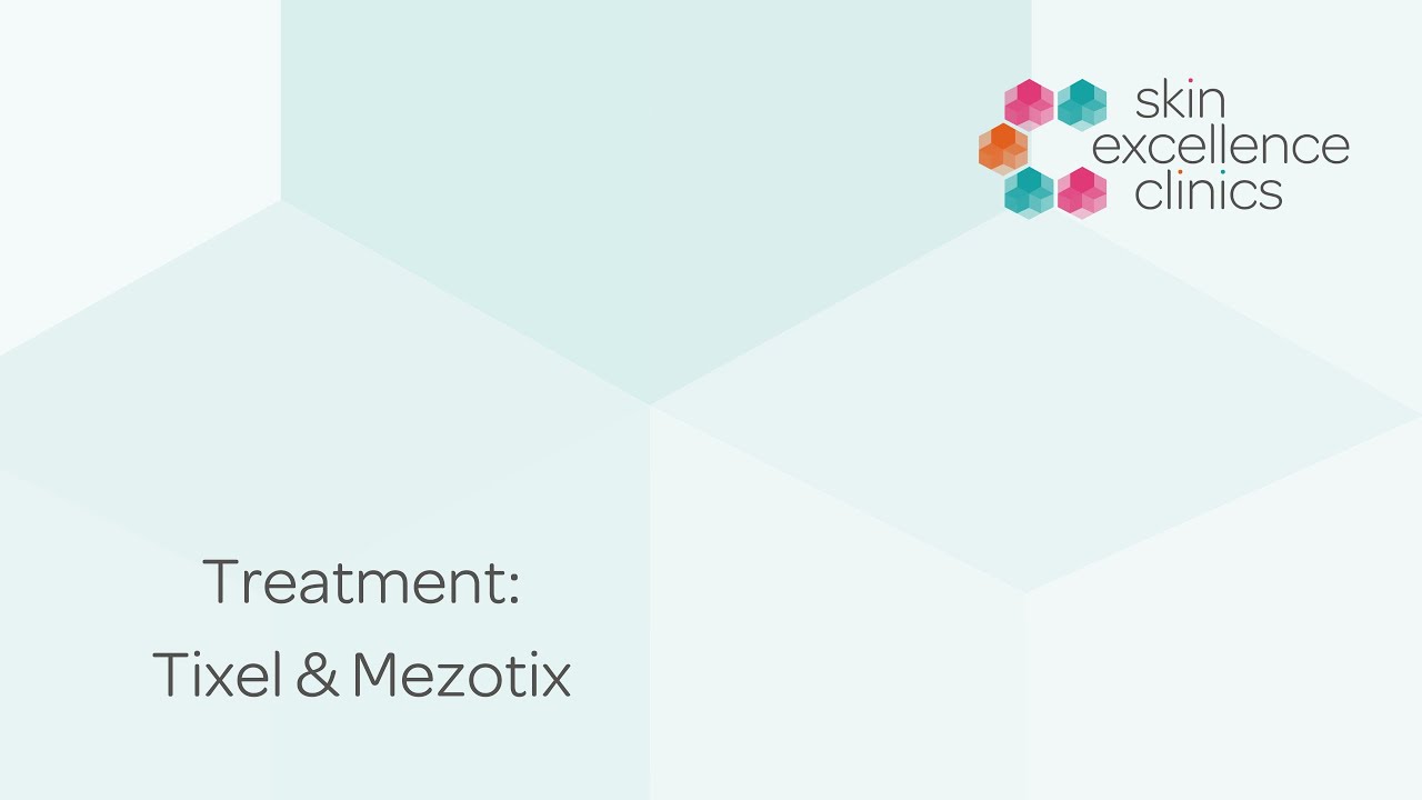 Tanis has a Tixel /Mezotix Treatment