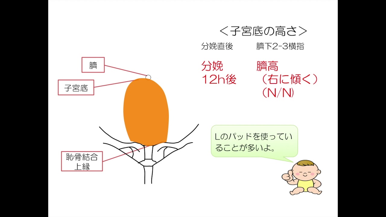 産後の子宮復古の観察