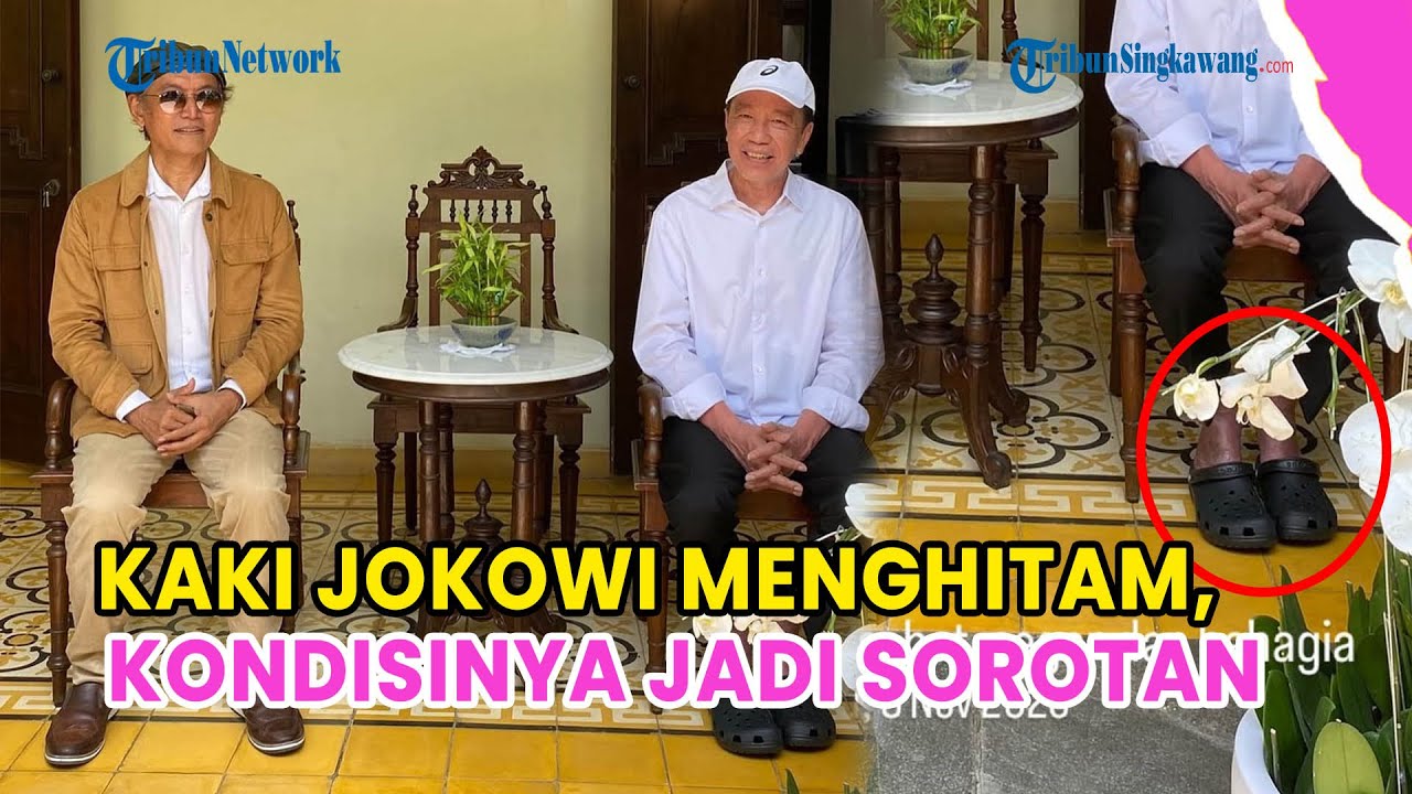 POTRET KAKI JOKOWI MENGHITAM❗KESEHATANNYA DIPERTANYAKAN