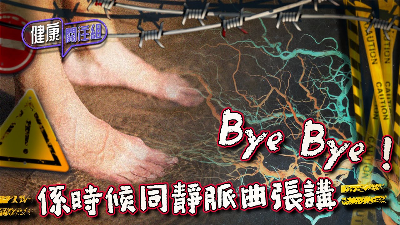 健康關注組｜ EP206 PT2｜ 係時候同靜脈曲張講 Bye Bye！ ｜  靜脈曲張 ｜ 敖嘉年 ｜ 黃芳雯 ｜ HOY TV 77台