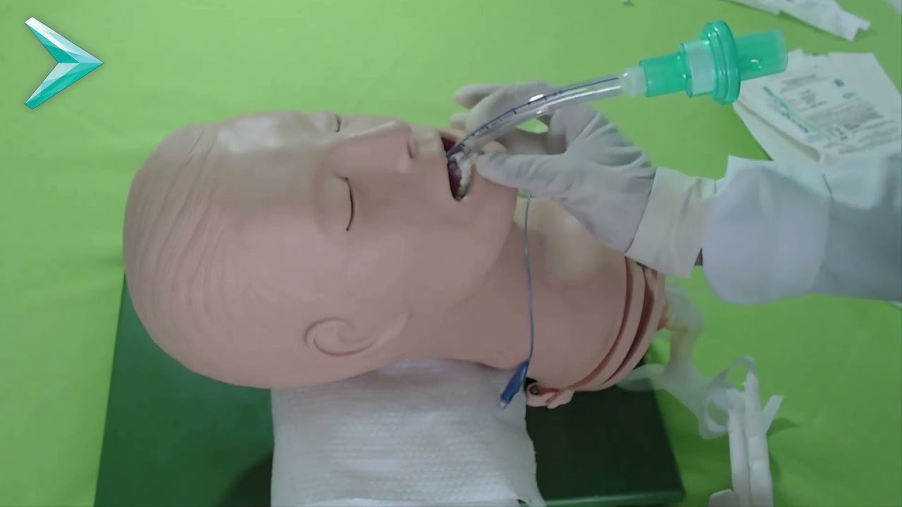 COT CADARÇO - CÂNULA OROTRAQUEAL FIXAÇÃO COM CADARÇO