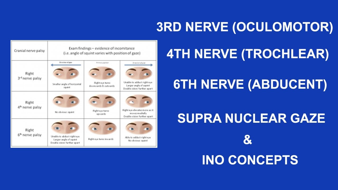 3RD OCULOMOTOR, 4TH TROCHLEAR, 6TH ABDUCENT NERVES,SUPRA NUCLEAR GAZE & INO CONCEPTS