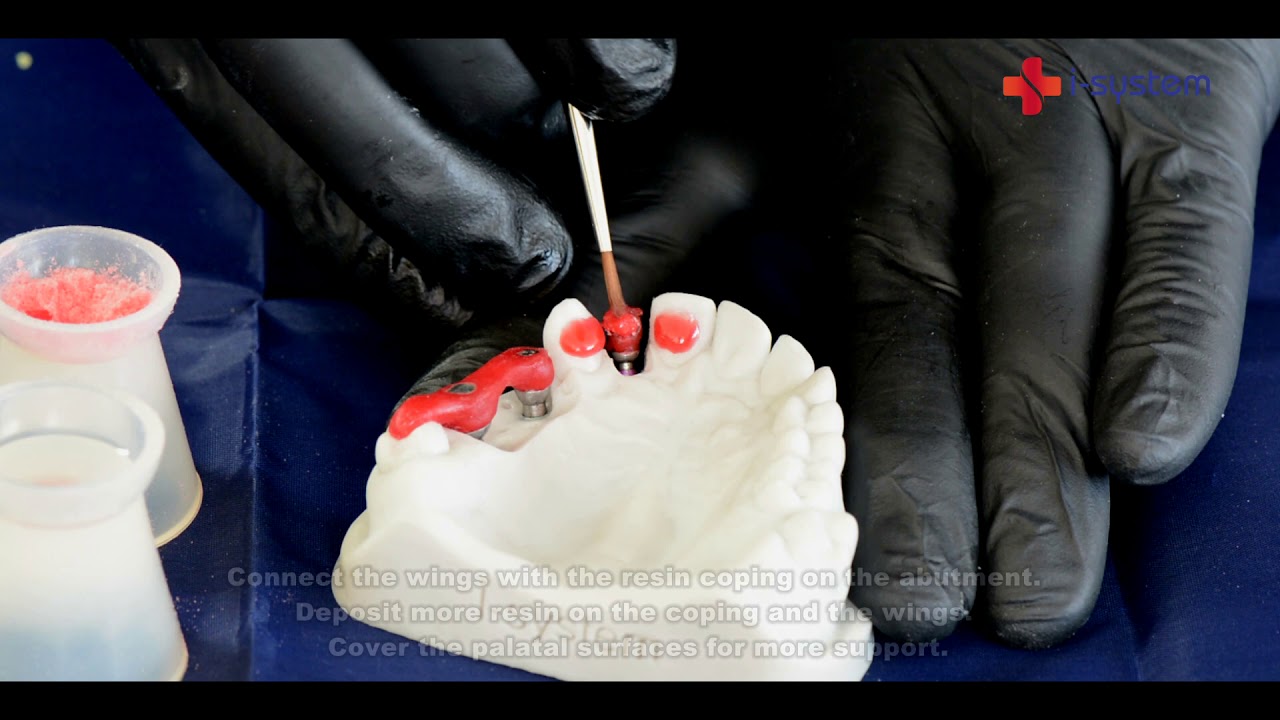 I-system Verification Jig: Single Restoration