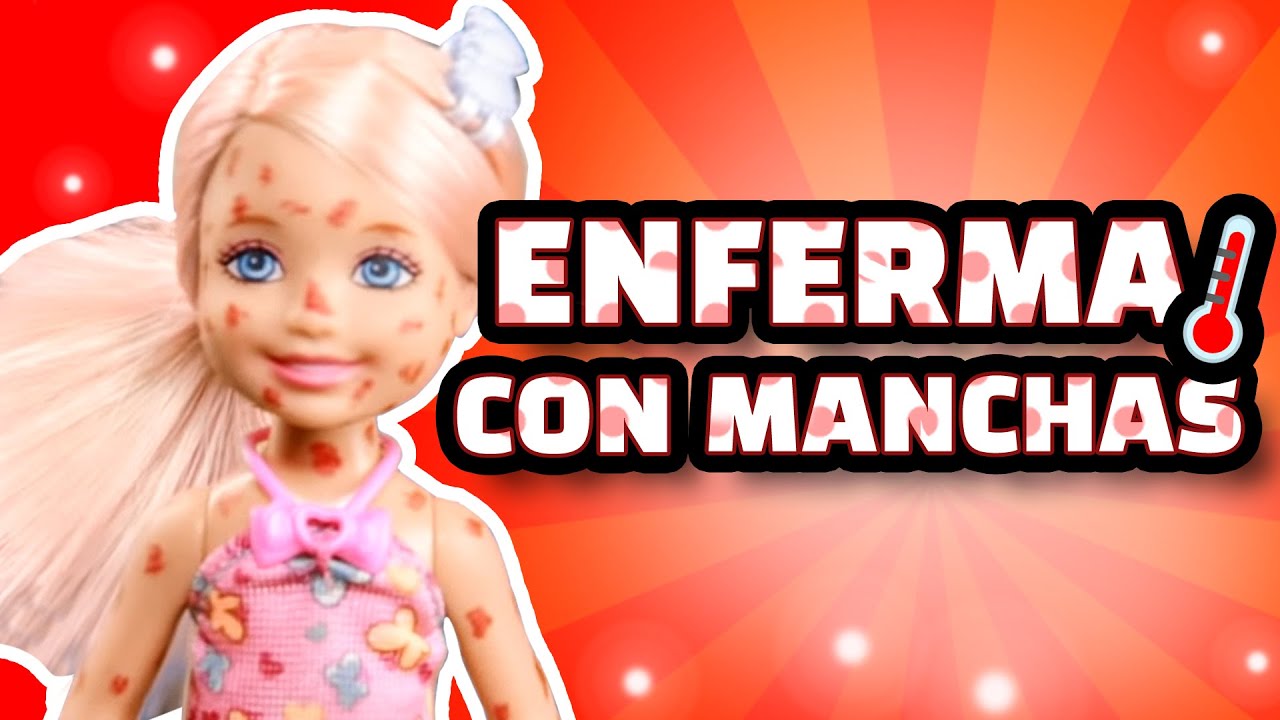 Barbie - Enferma y llena de Manchas | Ep.13
