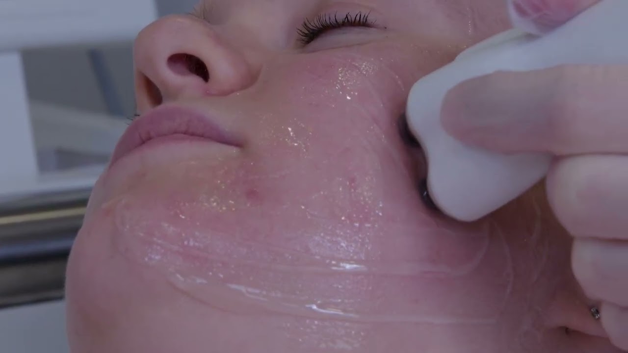 Venus Freeze Treatment | Eden Skin Clinic Treatments