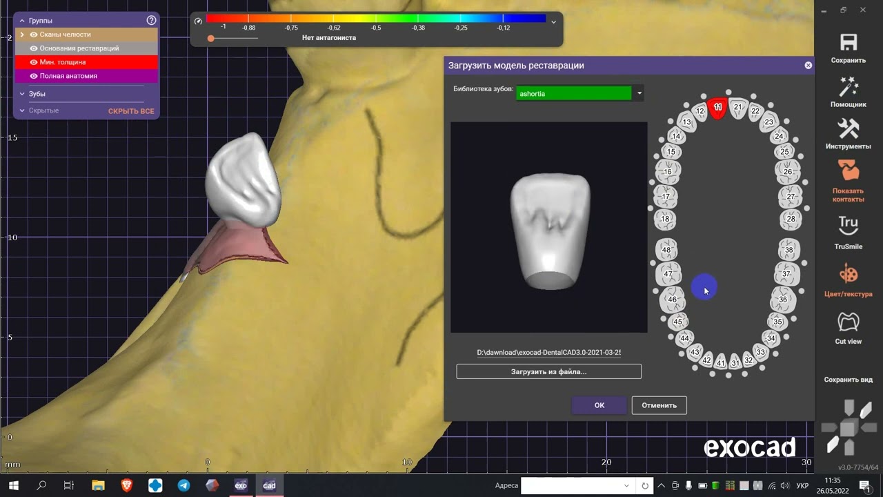 sdfa to stl Exocad v2