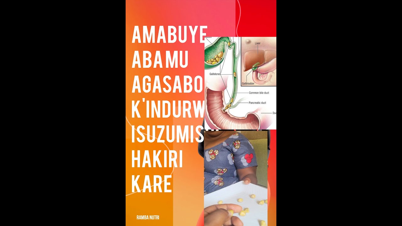 IBINTU YARWAYE BYARI BIKOMEYE YADUHAYE UBUHAMYA TURUMIRWA .