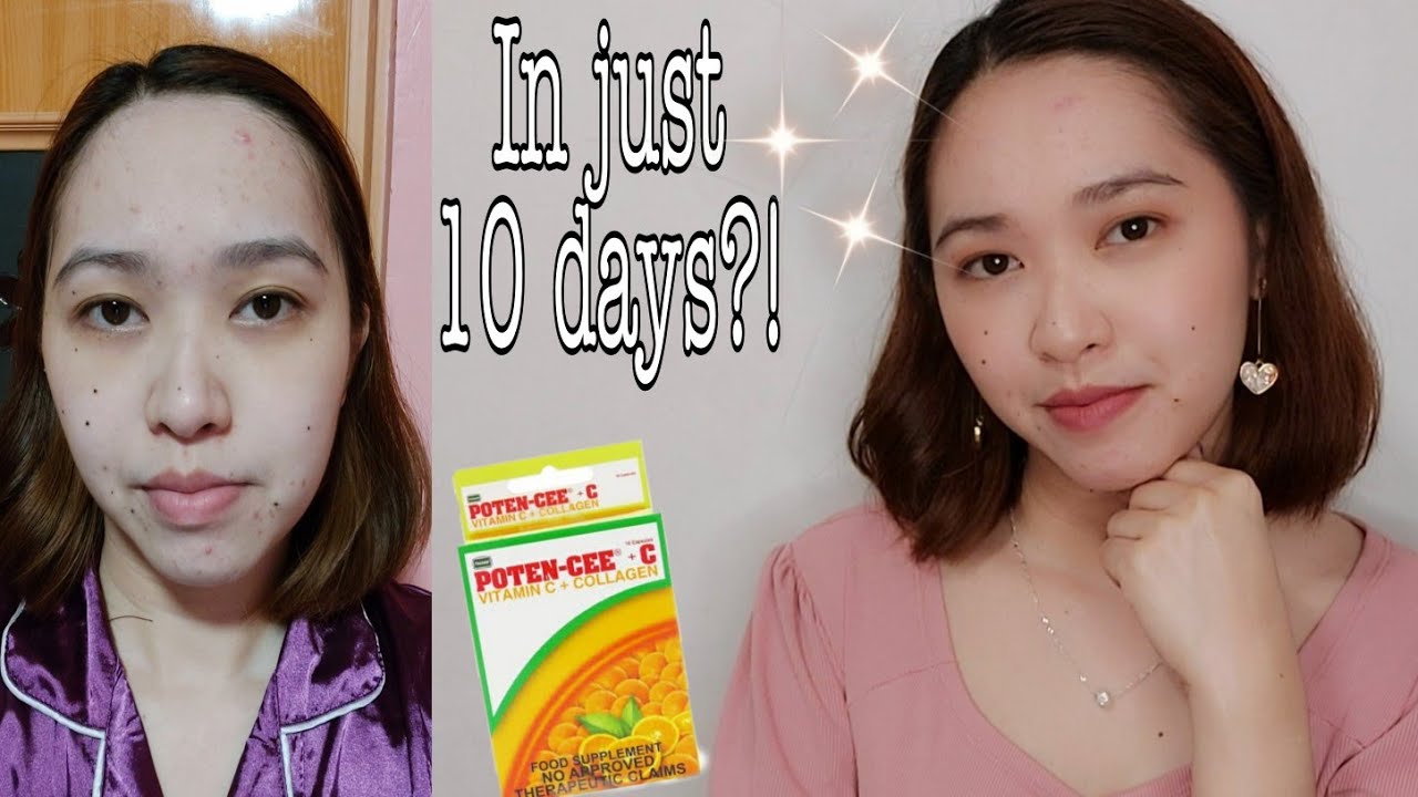 Poten Cee Collagen Review | Effective Collagen Supplement