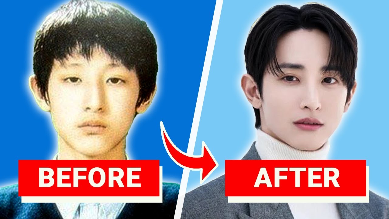 Korean Actors With The Most Unbelievable Plastic Surgeries (Part 1)