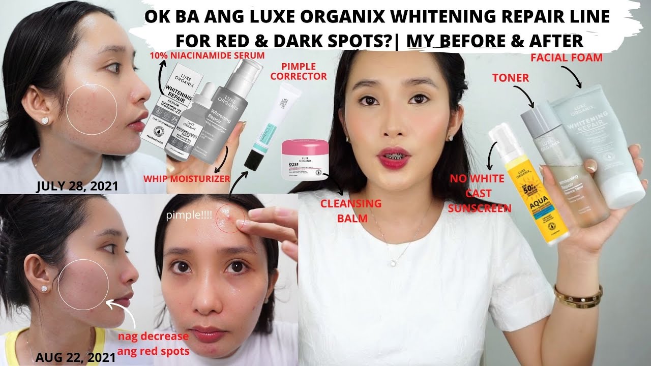 BEFORE & AFTER | LUXE ORGANIX WHITENING REPAIR LINE | LUXE ORGANIX REVIEW | GALY GASCON
